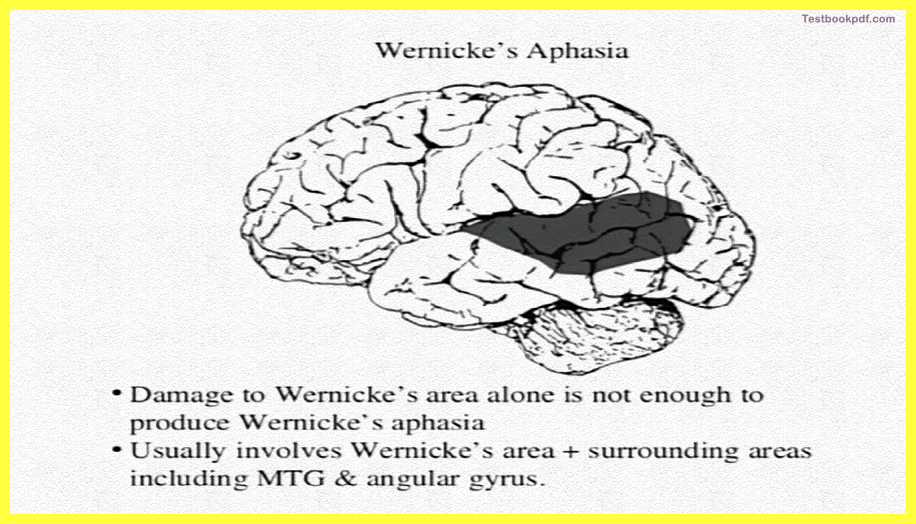 Wernicke’s Aphasia-The-Cerebral-Cortex-Psychology-Theory-Images-Pdf-Download