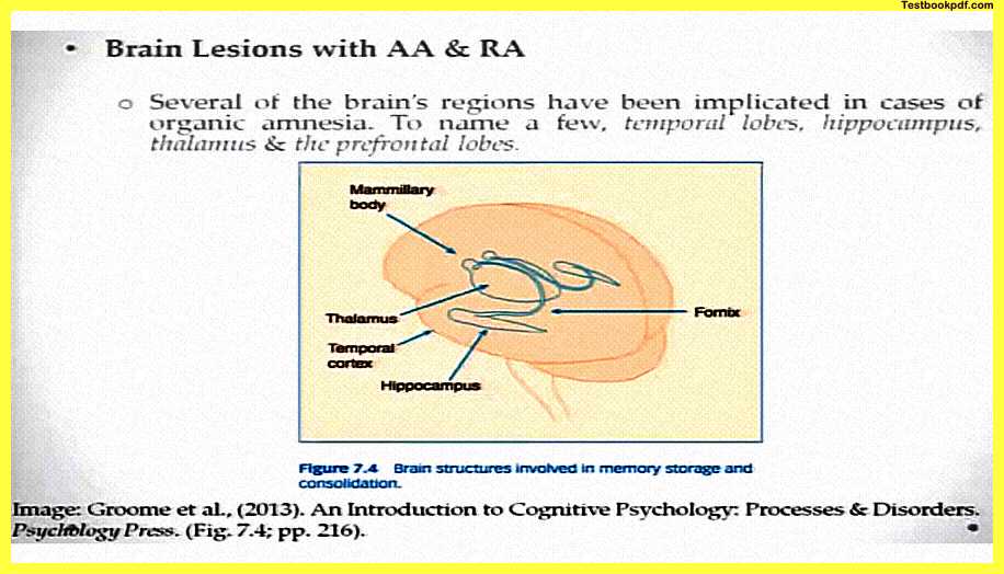 Disorders-of-Memory-in-psychology-Pdf-Download-Amnesia